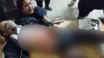বরিশালে যুবলীগ নেতাকে কুপিয়ে পায়ের রগ কাটল দুর্বৃত্তরা, অভিযোগের তীর যুবদল নেতার দিকে