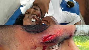 আগৈলঝাড়ায় বিএনপির মনোনয়ন বঞ্চিত নেতার সমর্থককে পিটিয়ে ও কুপিয়ে যখম।।