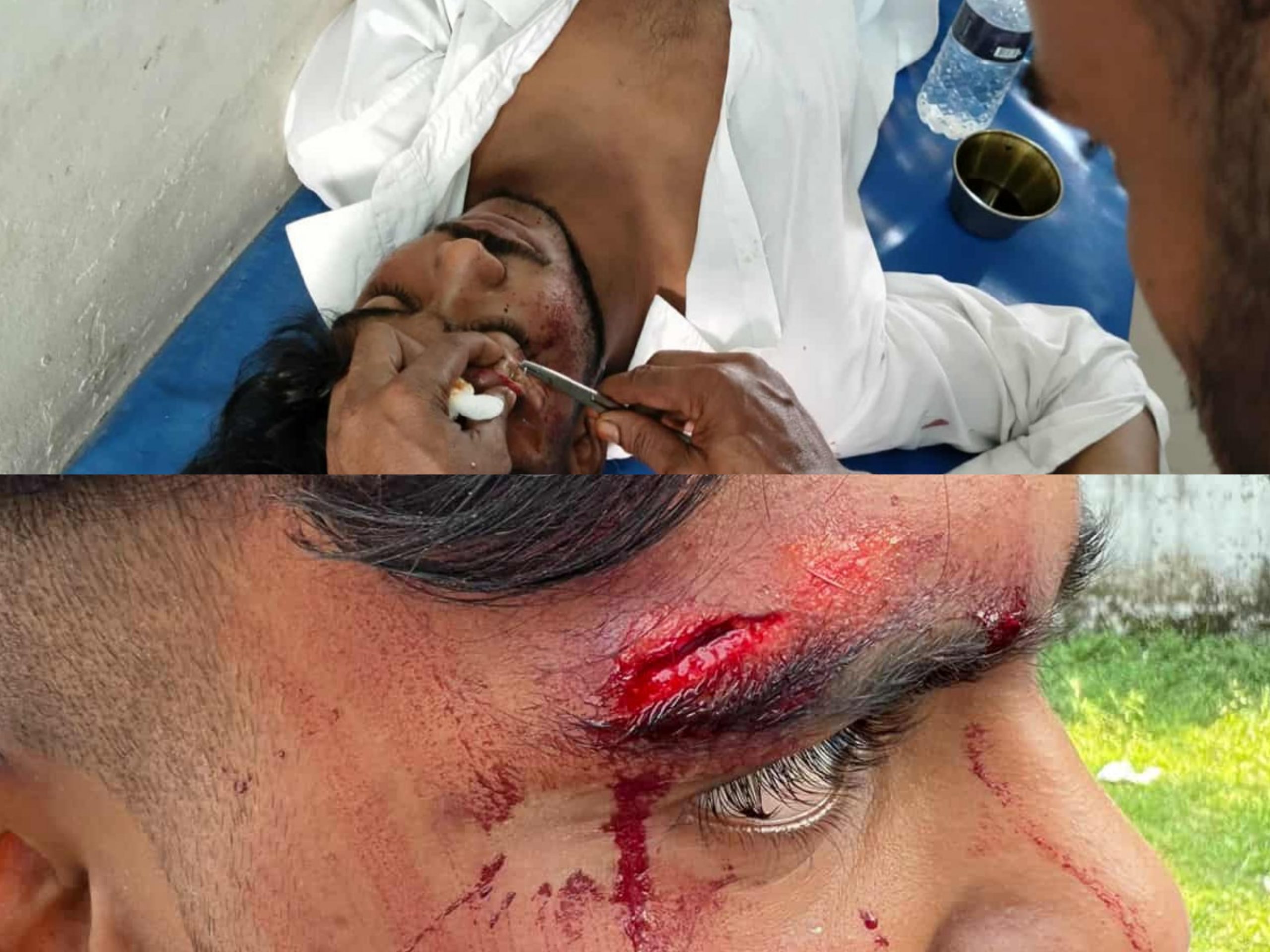 আগৈলঝাড়ায় বিএনপির মনোনয়ন বঞ্চিত নেতার সমর্থককে পিটিয়ে ও কুপিয়ে যখম।।