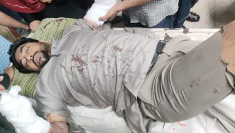 রাজাপুরে ছাত্রদল নেতাকে কু/পি/য়ে জ/খ/ম, শেবাচিমে ভর্তি,ঢাকায় রেফার