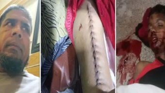 বরিশালে আনসার বাহিনীর গাড়ি চাপায় শিশু নিহত, গুরুতর আহত মা, তিন মাসেও পায়নি বিচার,অভিযোগ পরিবারের