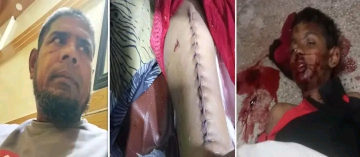 বরিশালে আনসার বাহিনীর গাড়ি চাপায় শিশু নিহত, গুরুতর আহত মা, তিন মাসেও পায়নি বিচার,অভিযোগ পরিবারের
